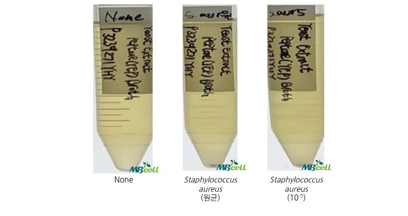 [Yeast Extract Peptone (YEP) Broth]
